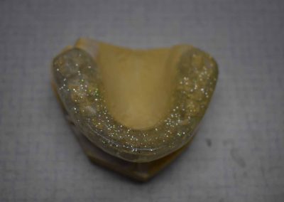 hopkins dental laboratory teeth 3