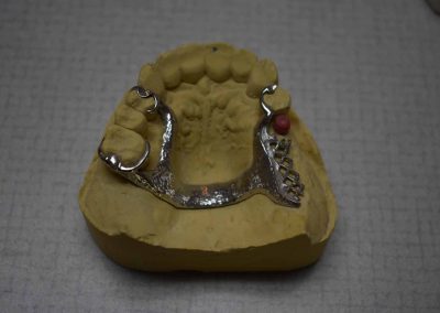 hopkins dental laboratory teeth 1